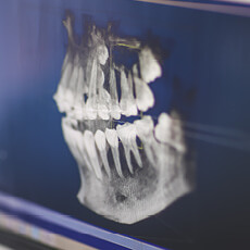 hartenbos-tandartse-dental-homepage-circles