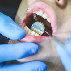 hartenbos-tandartse-dental-homepage-circles7